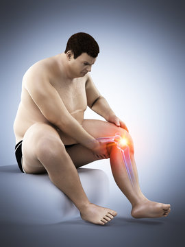3d rendered medically accurate illustration of an obese mans painful knee
