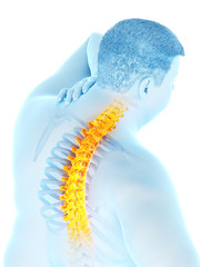Naklejka premium 3d rendered medically accurate illustration of an obese mans painful back