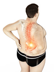 3d rendered medically accurate illustration of an obese mans painful back