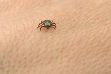 Tick on skin