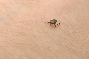 Encephalitis Tick Insect on Skin Macro Close-up