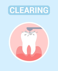 Dental Clearing, Tooth Drilling Vector Web Banner