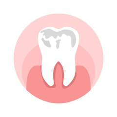 Caries, Holes in Tooth Flat Vector Illustration