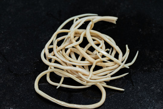Ascariasis is a disease caused by the parasitic roundworm Ascaris lumbricoides for education in laboratories.