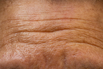 Senior woman's wrinkled forehead, Close up & Macro shot, Selective focus, Light & Shadow, Body part, Healthcare concept