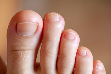 Men's toes, healthy toe nails