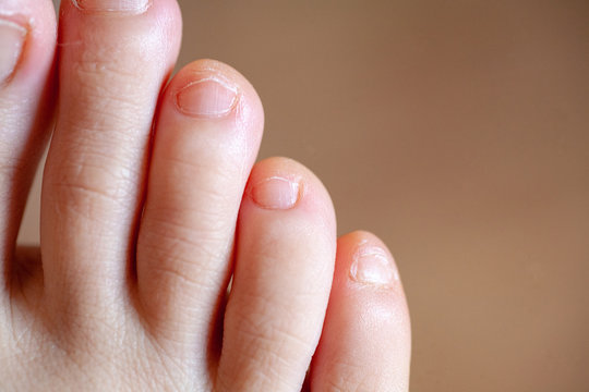 Как выглядят здоровые ногти на ногах Healthy Toenails Изображения: просматривайте стоковые фотографии, векторные изоб