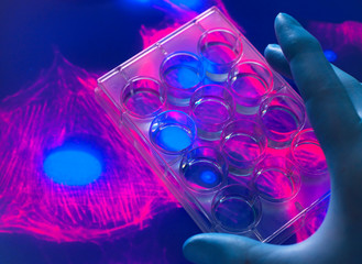 Cell biologist viewing stem cells cultivated red growth medium in a culture jar with the microscope image of the cell structure in the background