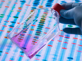 Genetic Engineering, Scientist viewing cells in a culture jar with a DNA profiles on a screen in the background illustrating gene editing