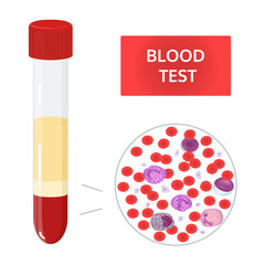 Medical vector concept: blood analysis in test tubes and composition of blood under microscope. Red and white blood cells, platelets image.