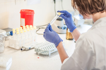 Medical laboratory close-up test-tube
