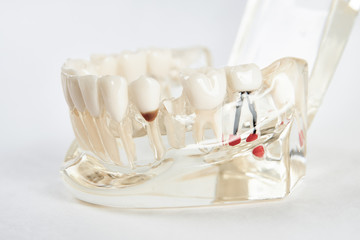 Artificial teeth on a white background with copy space, close-up