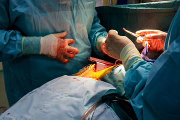 Surgeon with surgical instrument during the open heart operation
