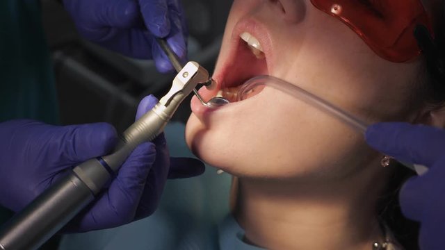 Dentist is taking care about patient's tooth using electric dental brush, opening patient's mouth closeup. Nurse with saliva ejector near the patient. Teeth care concept.