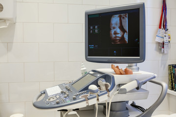 Ultrasound 3d photo of unborn baby in mother's womb, ultrasonographer apparatus
