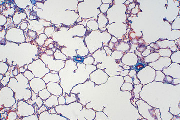 Human lung tissue under microscope view.