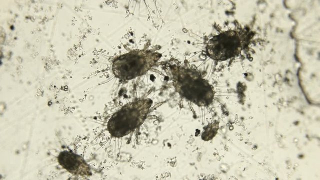 a granary or flour mite under a microscope, the name Acaroidea, Acarus siro, is a pest that destroys products such as corn, cheese, fruits and many others