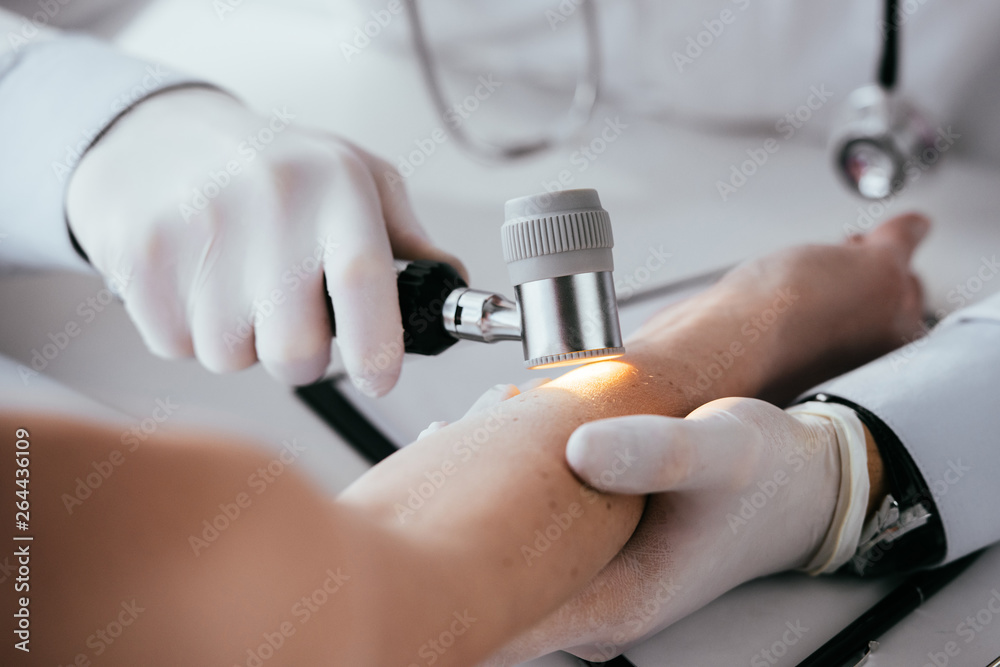 Wall mural cropped view of dermatologist examining hand of woman while holding dermatoscope