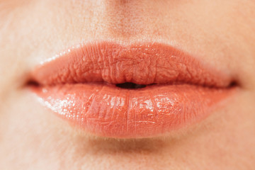 close up of herpes on lips of sick woman
