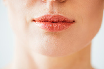 Obraz premium cropped view of herpes on lips of woman isolated on white