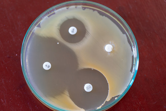 「ブドウ球菌」の画像 6,676 件の Stock 写真、ベクターおよびビデオ Adobe Stock