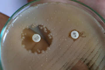 Drug testing of microbiology laboratory.