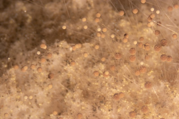 Backgrounds of Colony Characteristics of Mold under the microscope.