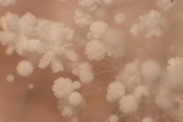 Backgrounds of Colony Characteristics of Mold under the microscope.