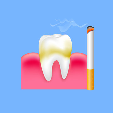 Tooth with cigarette. Smoking effect on human teeth. Dental care concept. Stop smoking, World No Tobacco Day. Illustration on blue background.