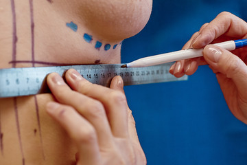 Closeup Of Naked Woman Body With Black Surgical Marks On Her Breast. Doctor Hands Drawing Lines On...