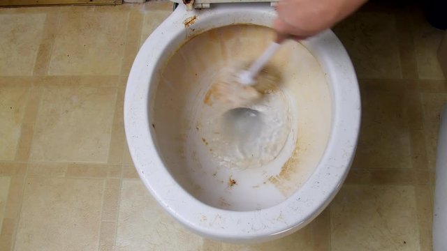 Dirty toilet bowl.