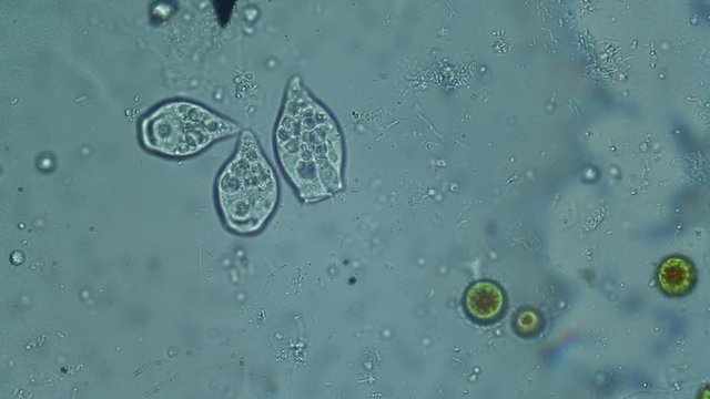 Movements of three vorticelle seen with an optical microscope
