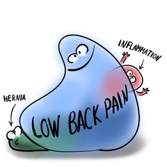 Nonspecific low back pain overshadows other causes