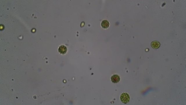 microscopic green algae in a laboratory sample taken from the water of a pond