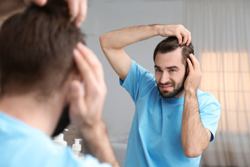 Young man with hair loss problem in front of mirror indoors