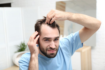 Young man with hair loss problem indoors - obrazy, fototapety, plakaty