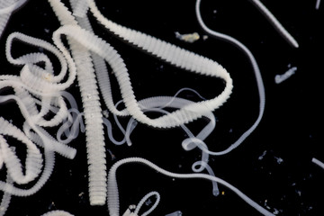 The study of Tapeworm infection is caused by ingesting food or water contaminated with tapeworm...