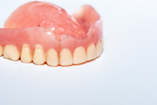 Old denture on a white background.