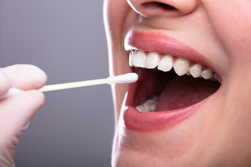 Dentist's Hand Taking Saliva Test From Woman's Mouth