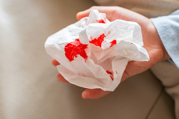 kids hand with bloody tissue