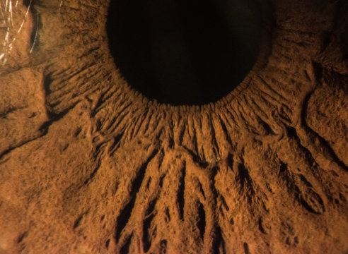 close-up images of human eye, iris and cornea from slit lamp biomicroscope for eye diagnosis.