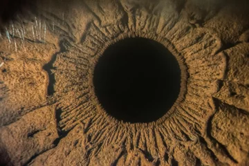 Schilderijen op glas close-up images of human eye, iris and cornea from slit lamp biomicroscope for eye diagnosis. © cattyphoto