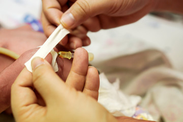 Nurse hands using medical adhesive plaster stick and wrap safely on IV Catheter and sick newborn baby's hand  for prepare fill the saline solution and medicine.