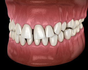 Healthy human teeth with normal occlusion, side view. Medically accurate tooth 3D illustration