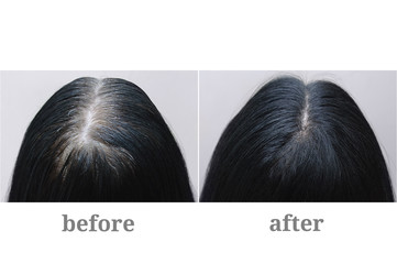 Head of a girl with black gray hair. Hair coloring.Top of the head. Before and after.