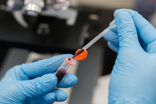 the veterinarian taking two drops of blood with the pipette from a collecting tube with heparin