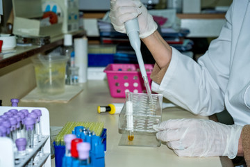 laboratory,scientist,drug test,healthcare and medicine,medical research,females,biology,analyzing,diagnostic medical tool,forensic science,medical sample,patient,medical equipment,urine sample,biochem