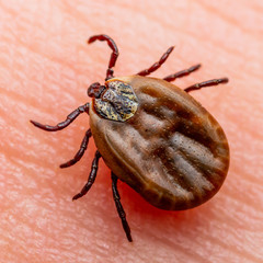 Encephalitis Virus or Lyme Borreliosis Disease Infectious Dermacentor Tick Arachnid Parasite Insect on Skin Macro