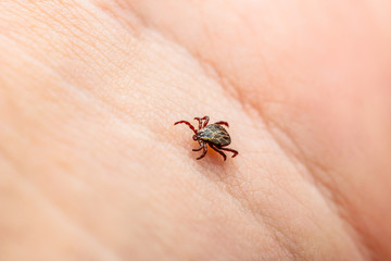 Encephalitis Virus or Lyme Borreliosis Disease Infectious Dermacentor Tick Arachnid Parasite Insect on Skin Macro