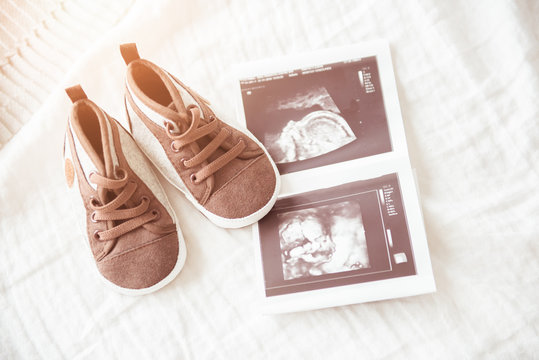 Brown booties next to baby photos with ultrasound. The concept of awaiting baby, pregnancy